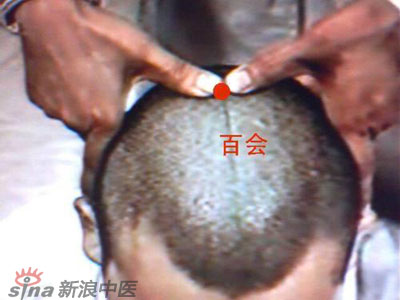 艾灸常用的保健穴有哪些？--百會
