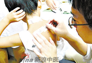 灸法的種類  你知道多少？